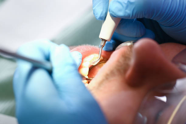 Best Emergency Cosmetic Dentistry (e.g., broken veneers) in Dalworthington Gardens, TX