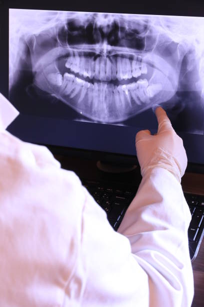 Best Knocked-Out Tooth (Avulsed Tooth) Treatment in Dalworthington Gardens, TX